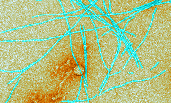 Amyloid fibrils