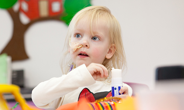 A small girl wearing a nasogastric tube. A revised approach for checking the position of nasogastric tubes that&nbsp;would enable more children to remain at home