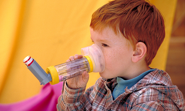 Asthma