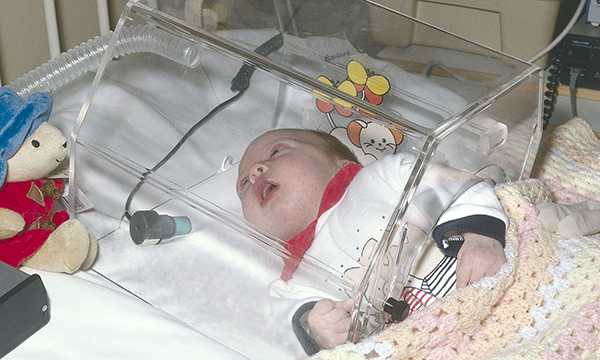 Bronchiolitis