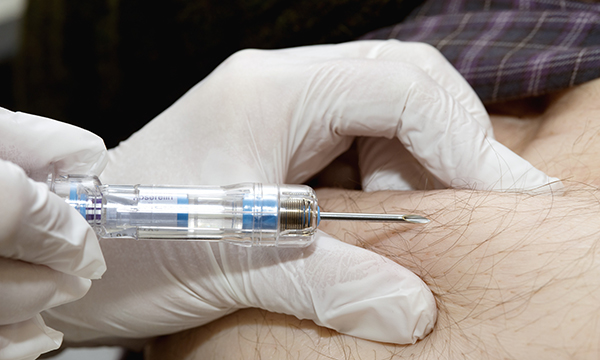 Zoladex implant in prostate cancer