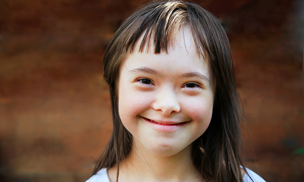 Down’s syndrome