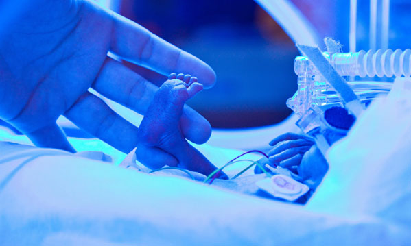 Jaundiced newborn