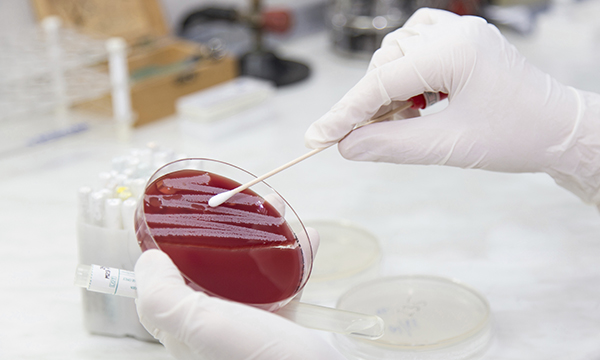 MRSA_culture