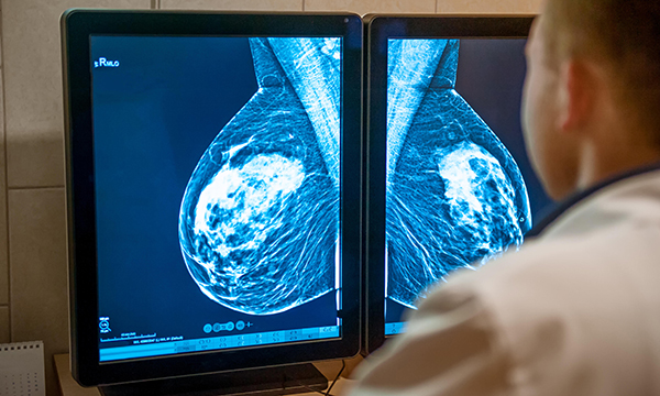 Mammogram