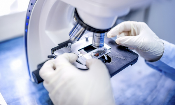 Oncocyte test