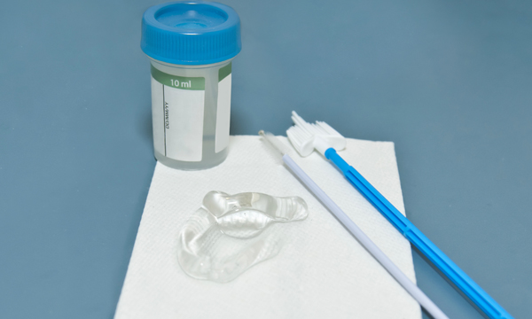 Smear test