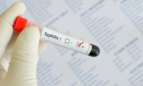 Syphilis