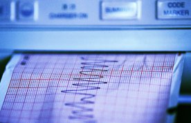 ECG read-out