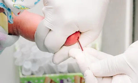 Blood test