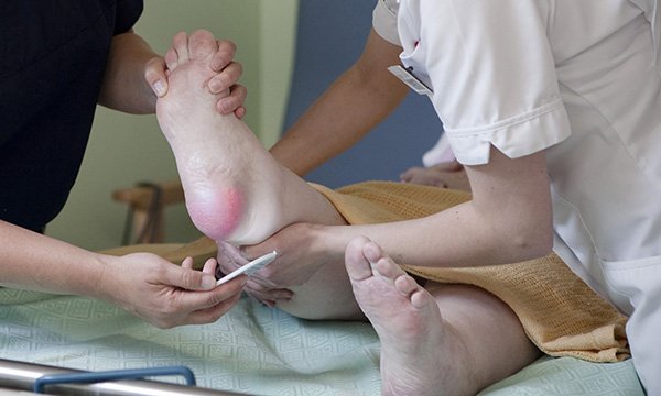 How to identify and categorise a pressure ulcer 