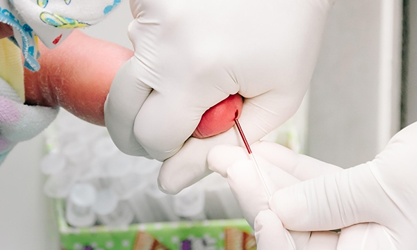 Blood test
