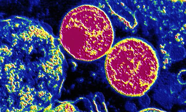 Chlamydia