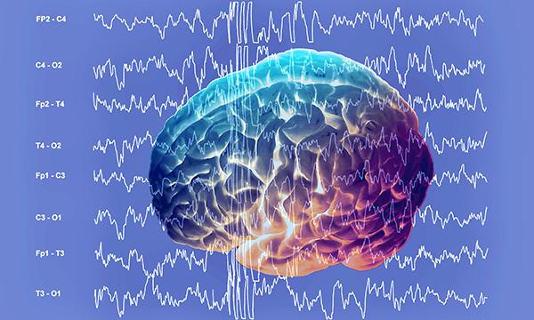 Epilepsy