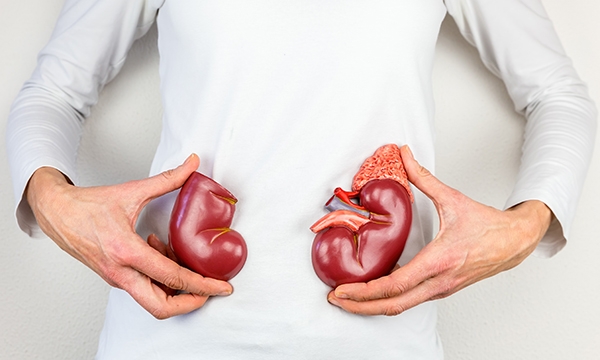 Kidney transplant