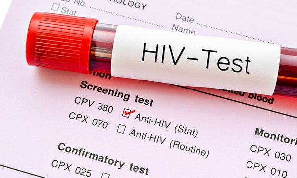 hiv