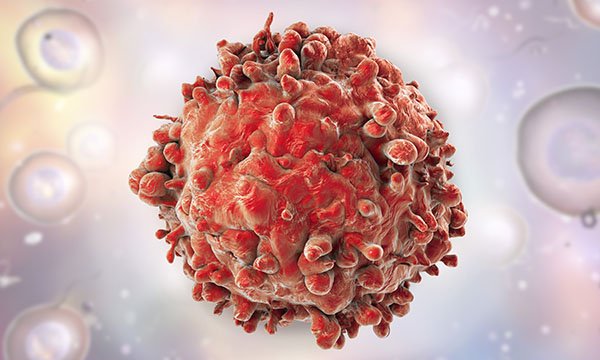 blood cancer