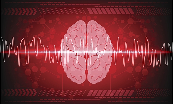 Epilepsy