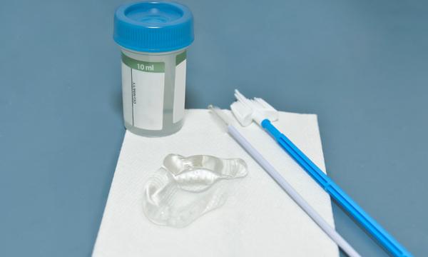 Smear test