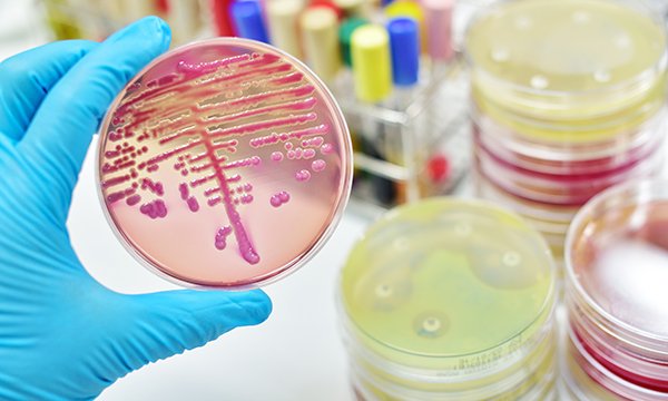 Strep B screening