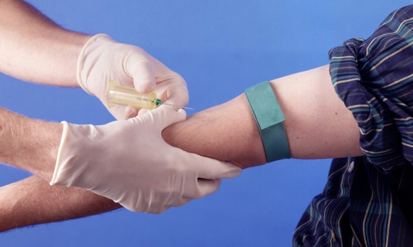 Venupuncture