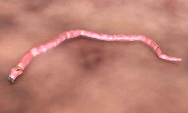 parasitic worms