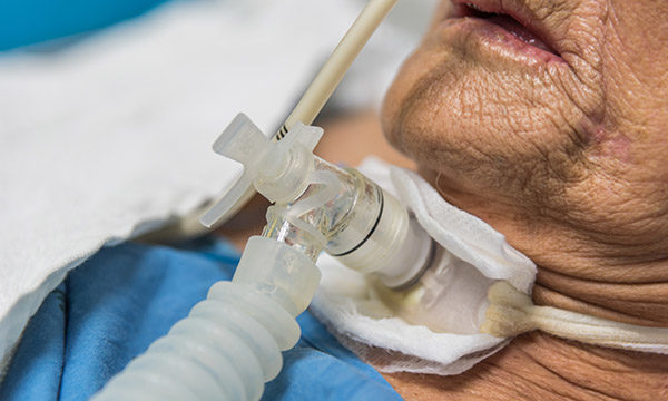 Care of the critically ill patient with a tracheostomy